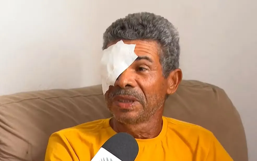 Cinco pacientes perdem visão após cirurgias de catarata em clínica de Salvador; 38 relatam complicações